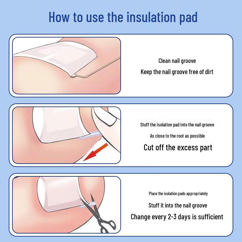 Ingrown Toenail Correction & Repair Kit