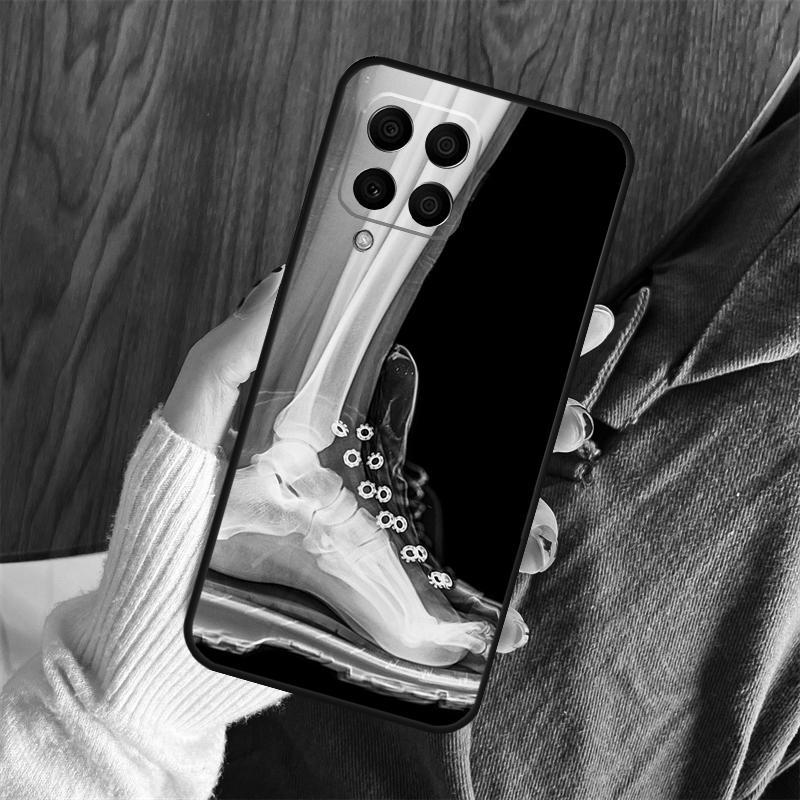 X-Ray Human Anatomy Case For Samsung Galaxy M11 M21 M31 M35 M12 M13 M14 M15 M16 M36 M56 M53 M32 M52 M55 M34 M54