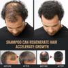 (3 Stück) Wurzelaktivator-Shampoo, Mähnenwurzelaktivator-Shampoo, Shampoo Wurzelaktivator Fördert das Haarwachstum Für Männer Haarverdichtendes Shampoo