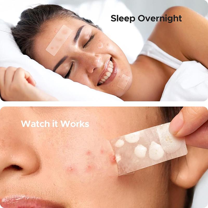 302Pcs Acne Patch Repair Acne Cleansing Invisible Breathable Waterproof Acne