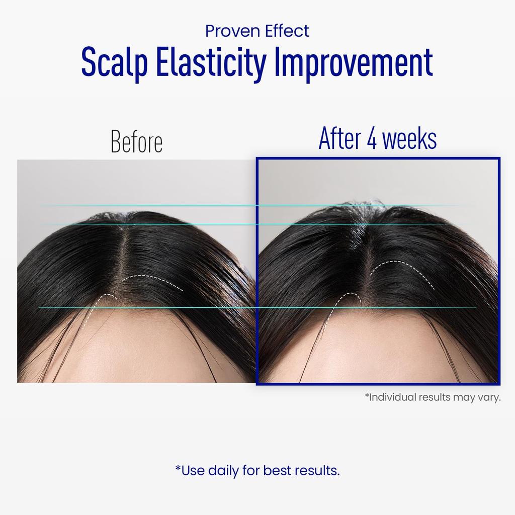 ViveLab Scalp Spioxyl React Shot 400 15ml