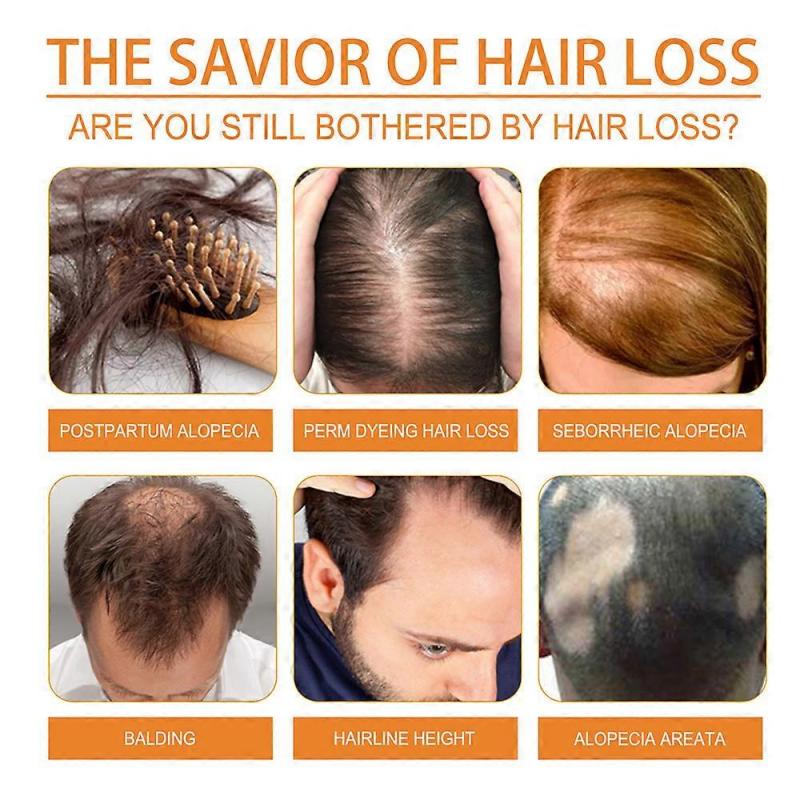 Natural Pumpkin Seed Oil Pure Hair Skin Care Treatment Growth Scalp Moisturizer