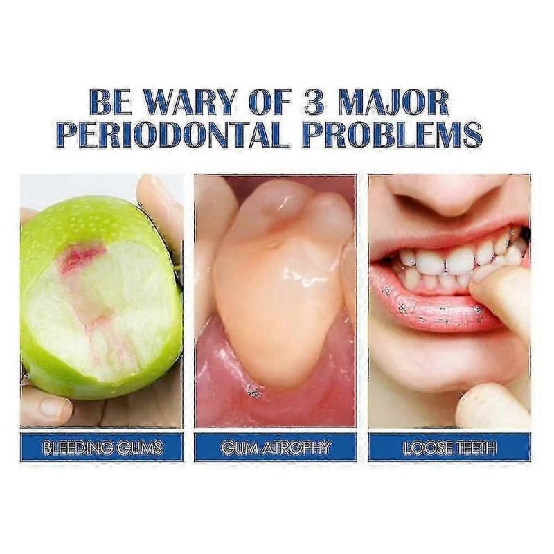 SOUTH MOON Gingival Fixation Toothpaste Curing Teeth Soothing Gingival Pa