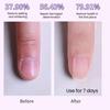 3.5ML 3-in-1 Nail Care Pen Cuticle Pusher Nail Oil Pen with Ceramic Tip Men Women Hangnail Dry Damaged Nails Cuticle Treatment Remover Pen