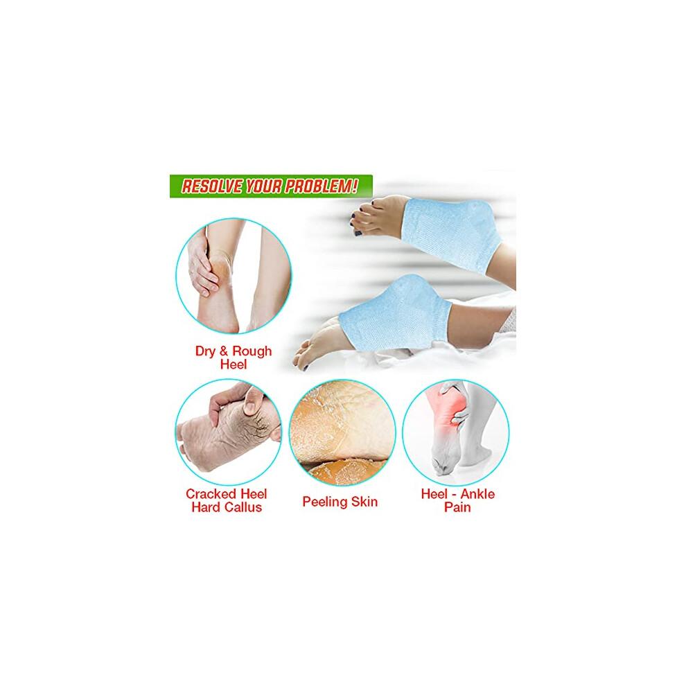 Crack Heel Repair Socks, Moisturizing Open Toe Socks For Dry Feet, Easy To Use During Rest Or Sleep, Flexible Cotton Blend Ensures Comfort And Fit,