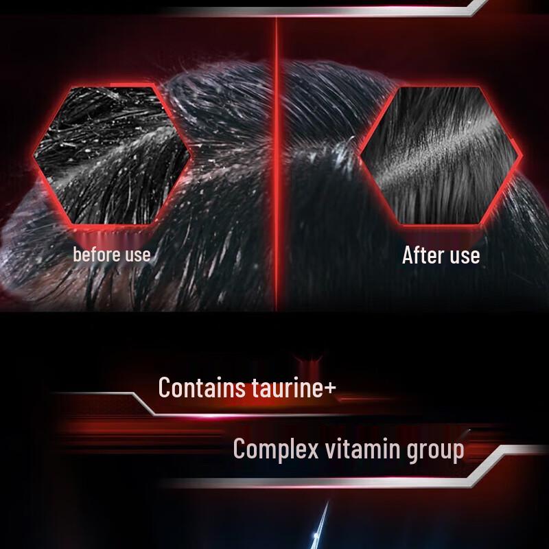 CLEAR Men's Deep Clean Anti-Dandruff Shampoo