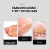 Umbrella Foot Callus Sanding Bit Diamond Carbide Dead Skin Removal Drill Bit  DIY Pedicure
