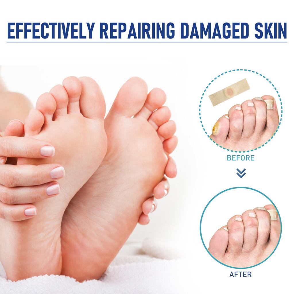 Extra Stärke – Nagelpflaster – 8-Stunden-Pflaster für die Zehennägel für die Nacht – 32 Stück