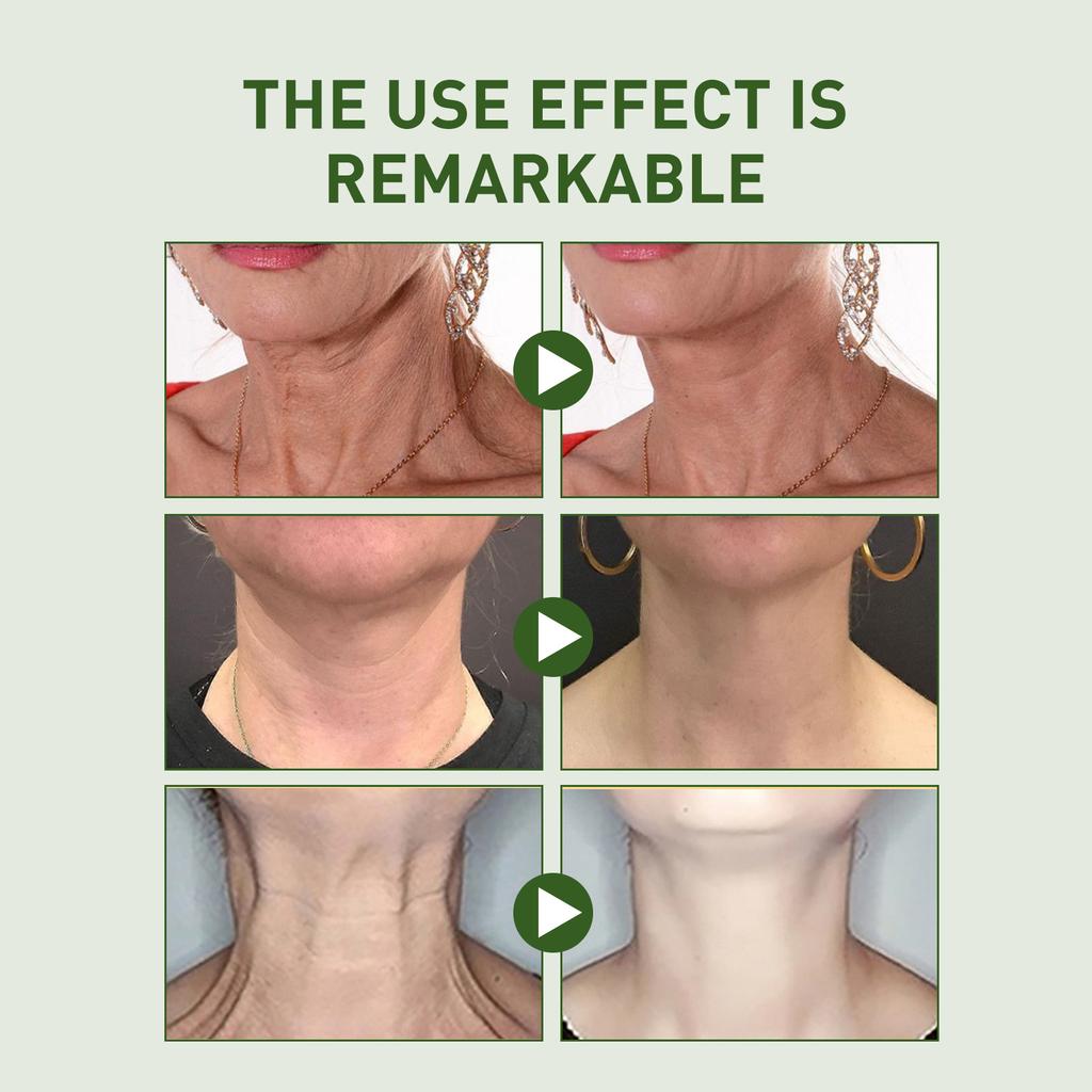 EELHOE Naturalny pantenol szyi ujędrniający krem do usuwania zmarszczek odmładzanie skóry nawilżający Anti-Aging wybielający krem do szyi pielęgnacja skóry