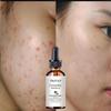 Face Essence Essential Oils Vitamin E Skin Oil 100% Nature Face Serum