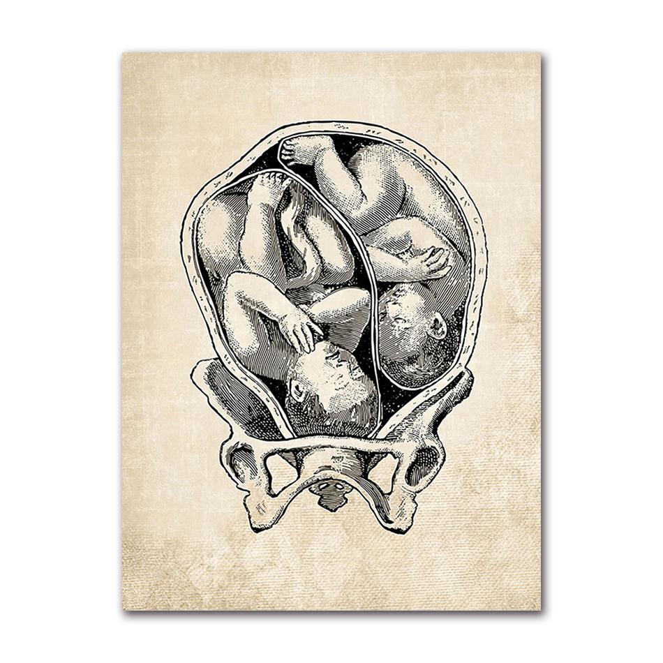 Wandbilder für Krankenhaus, Arzt, Büro, Dekor, Wandkunst, Leinwand, Malerei, Anatomie, Skelett, nordische Poster und Drucke, Vintage