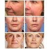 Face Cream with Retinol, Firming, Lifting, Anti-Aging, Against Fine Lines, Whitening, Brightening, Moisturising, Facial Skin Care
