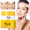 Chinese Astragalus Whitening Freckles Cream Remove Lightening Brighten Dark Spot Dry Face Care R8V8