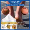 Chapped Hands and Feet Repair Cream, Moisturize, Nourish the Skin, and Leave the Skin Soft and Delicate