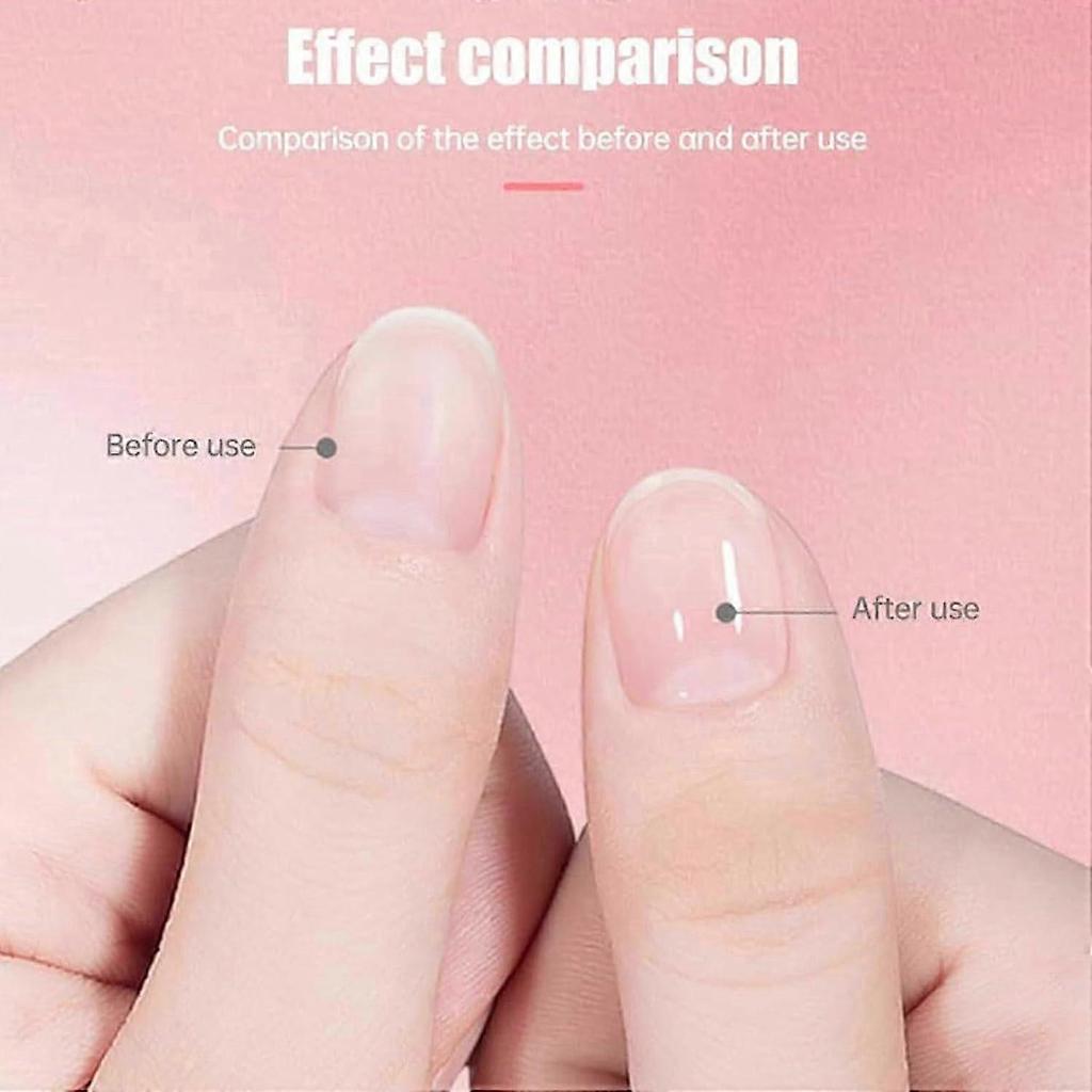 Aceite para el Crecimiento de Uñas Cosmético, Aceite Rejuvenecedor para el Crecimiento de Uñas, Aceite para el Crecimiento de Uñas Cosmético Rejuvenecimiento