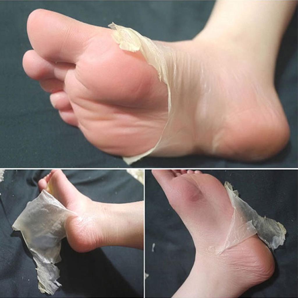 2pcs Exfoliating Foot Mask Pedicure Socks Peeling Feet Remove Dead Jon Malone Uygun Fiyatli Satin Alin Fiyat Ucretsiz Teslimat Fotograflarla Gercek Yorumlar Joom