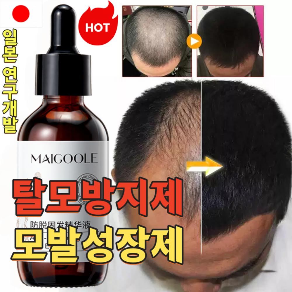 Hair Loss Pr Ion Supplement, Hair Loss Symptom Relief, Mild, Anti-hair Loss Hair Essence, Hair Growth Promoting Scalp Nourishing Care Essence