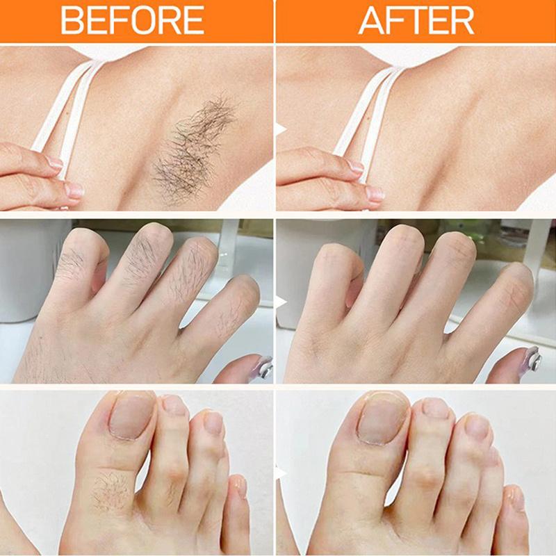 20 g Lippenhaarentfernungscreme für Männer und Frauen zur Entfernung von Lippenhaaren. Gesichtsschonende Entfernung von Bart. Achselhaarentfernungscreme