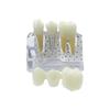 Modello Dimostrativo di Impianti Dentali 4 Volte Denti Analisi Impianti Corona Ponte Modello Rimovibile Per Studenti Dentisti Insegnamento Studio