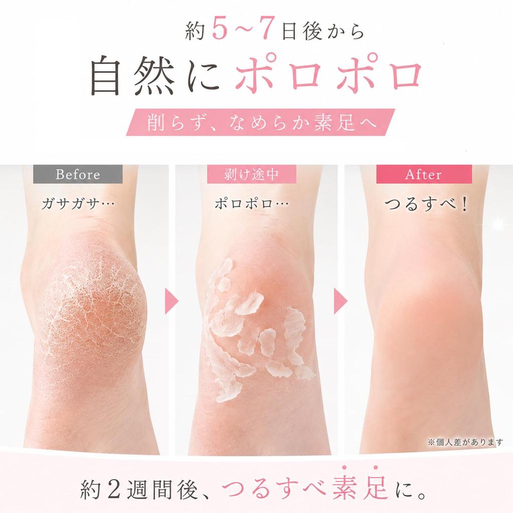 Marshmallow Bare Feet Foot Exfoliation Pack Just Wear It for 40 Minutes Removes Dead Skin Cells and Odor from Soles Foot Smoothing Foot Care Both - -