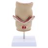 Human Pathologies of Rectum Model Medicals Teaching Tool Human Rectum Model Human Anatomy Model Teaching Supplies