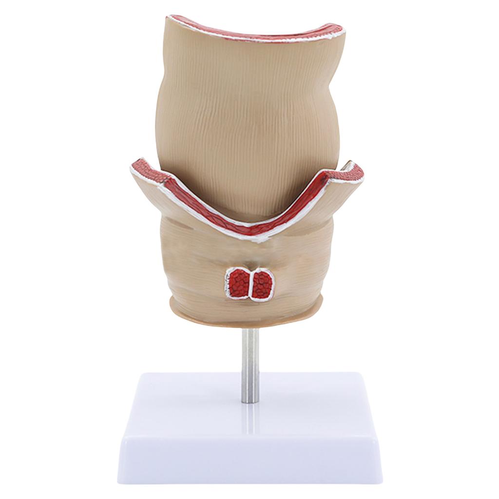 Human Pathologies of Rectum Model Medicals Teaching Tool Human Rectum Model Human Anatomy Model Teaching Supplies