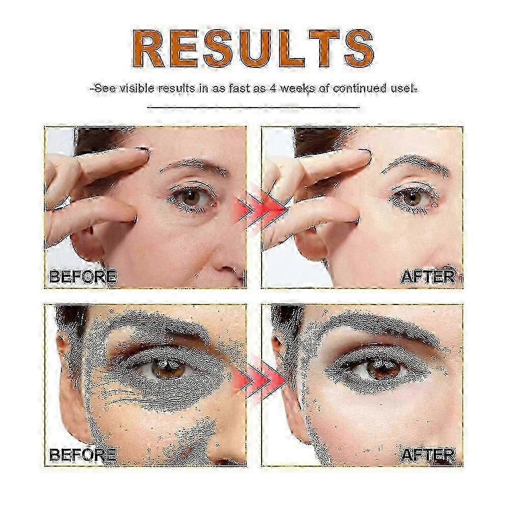 2 Stück Kollagen Anti-Falten Serum, Feuchtigkeitsspendend, Fleckenaufhellend, Hautbarriere-Reparierend, Neu eingetroffen