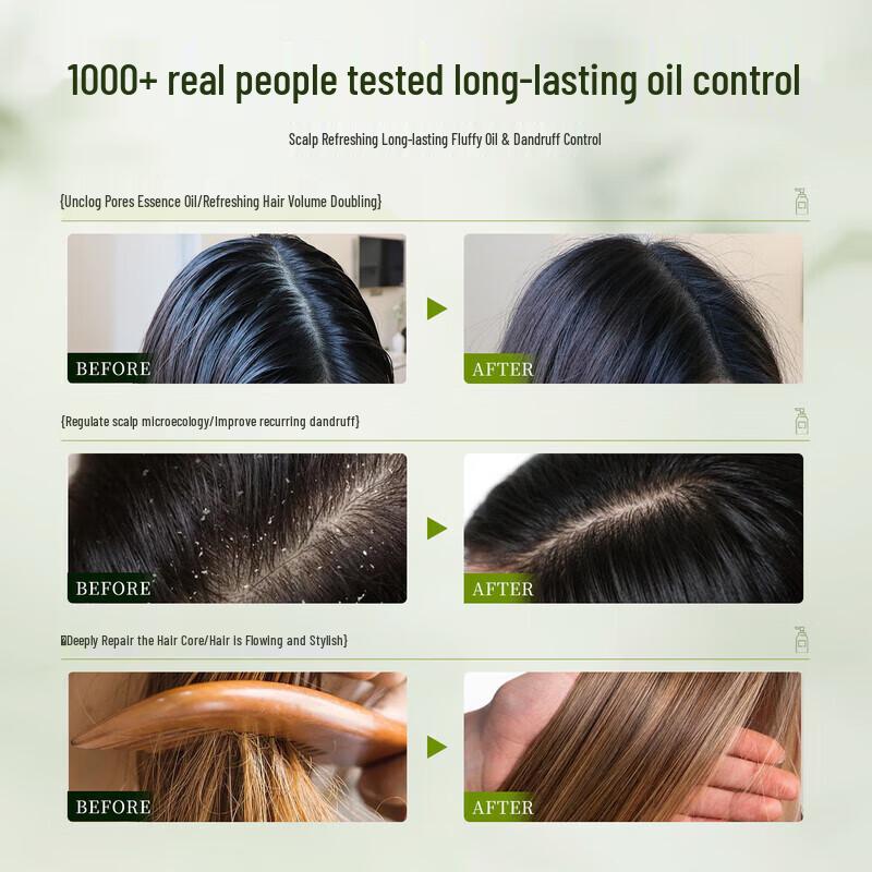 BEAI White Truffle Anti-Dandruff & Oil Control Shampoo