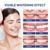 Instant Teeth Whitening Paint, Gentle, Non-Irritating Tooth Cleaning Coating, Effective Teeth Whitening Essence Gel Pen, Instant Whitening Dental Lacq