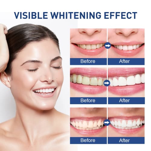 Instant Teeth Whitening Paint, Gentle, Non-Irritating Tooth Cleaning Coating, Effective Teeth Whitening Essence Gel Pen, Instant Whitening Dental Lacq