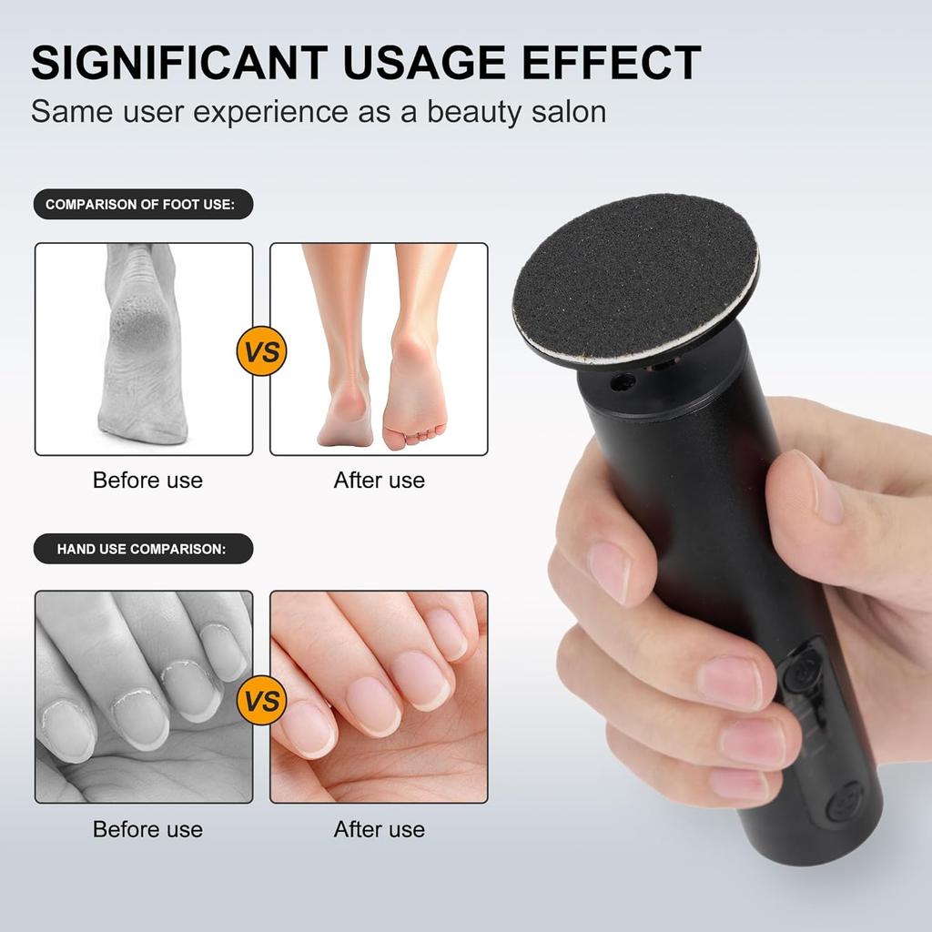 Callus Remover, Adjustable Speed Rechargeable Foot Sander Pedicure Tools for Feet Dead Skin with Sandpaper Disk an