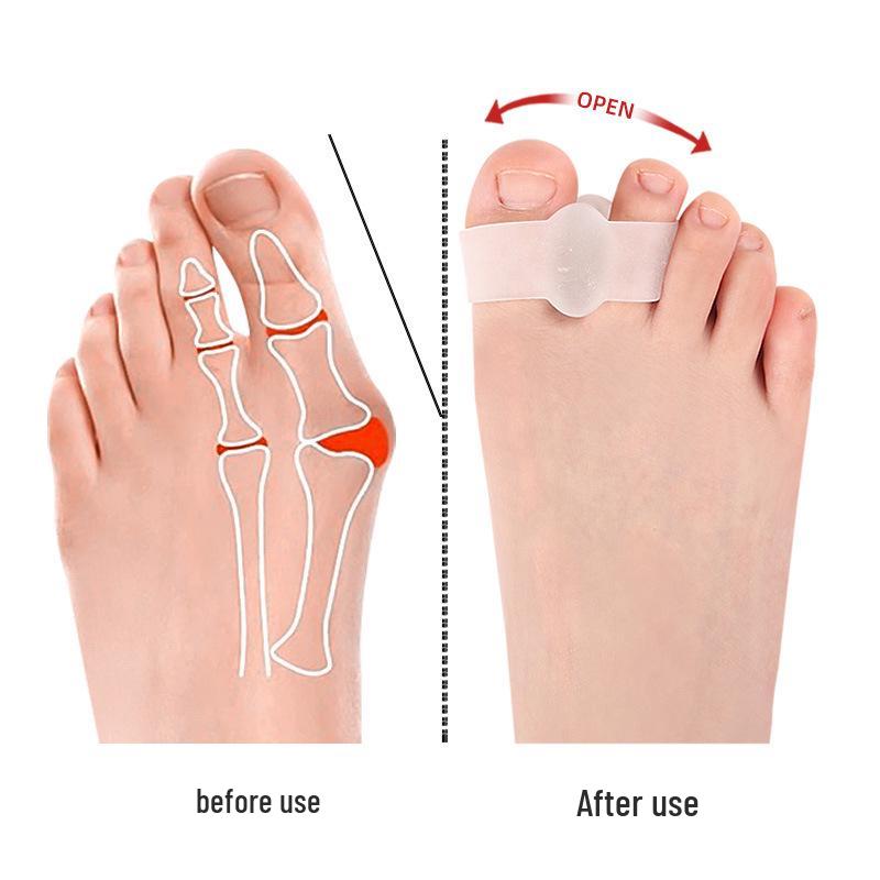Silicone Bunion Corrector Toe Separator