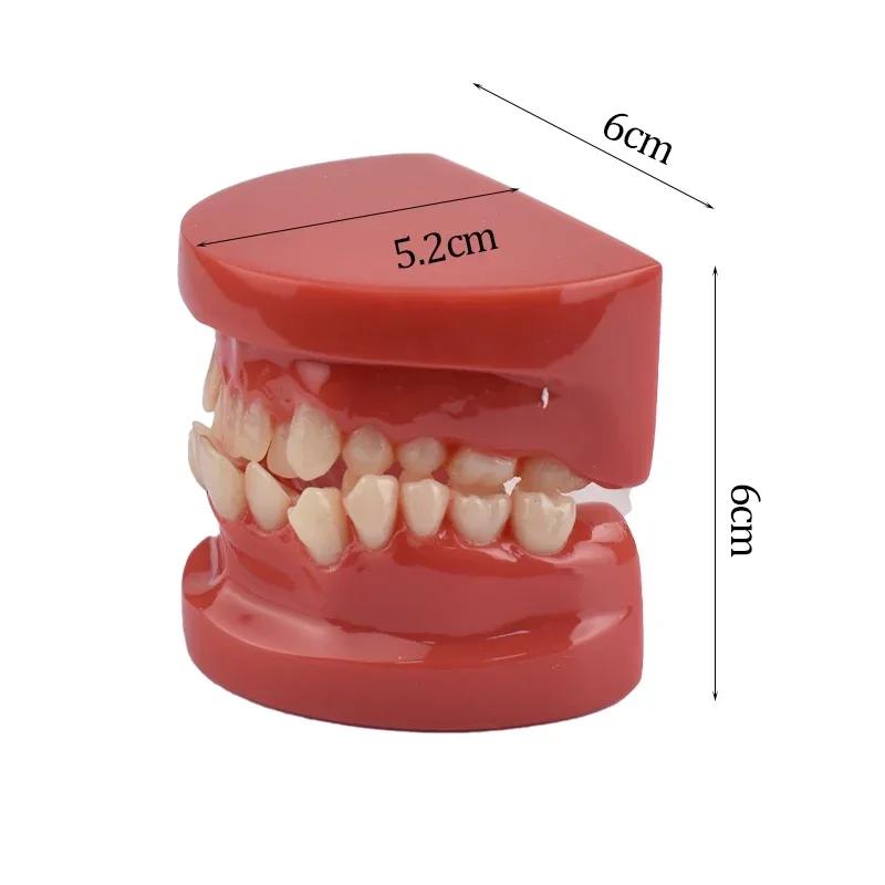Dental Lab Teeth Malocclusion Model Demonstration Model for Training Studying Teaching Oral Model Dentistry Tools