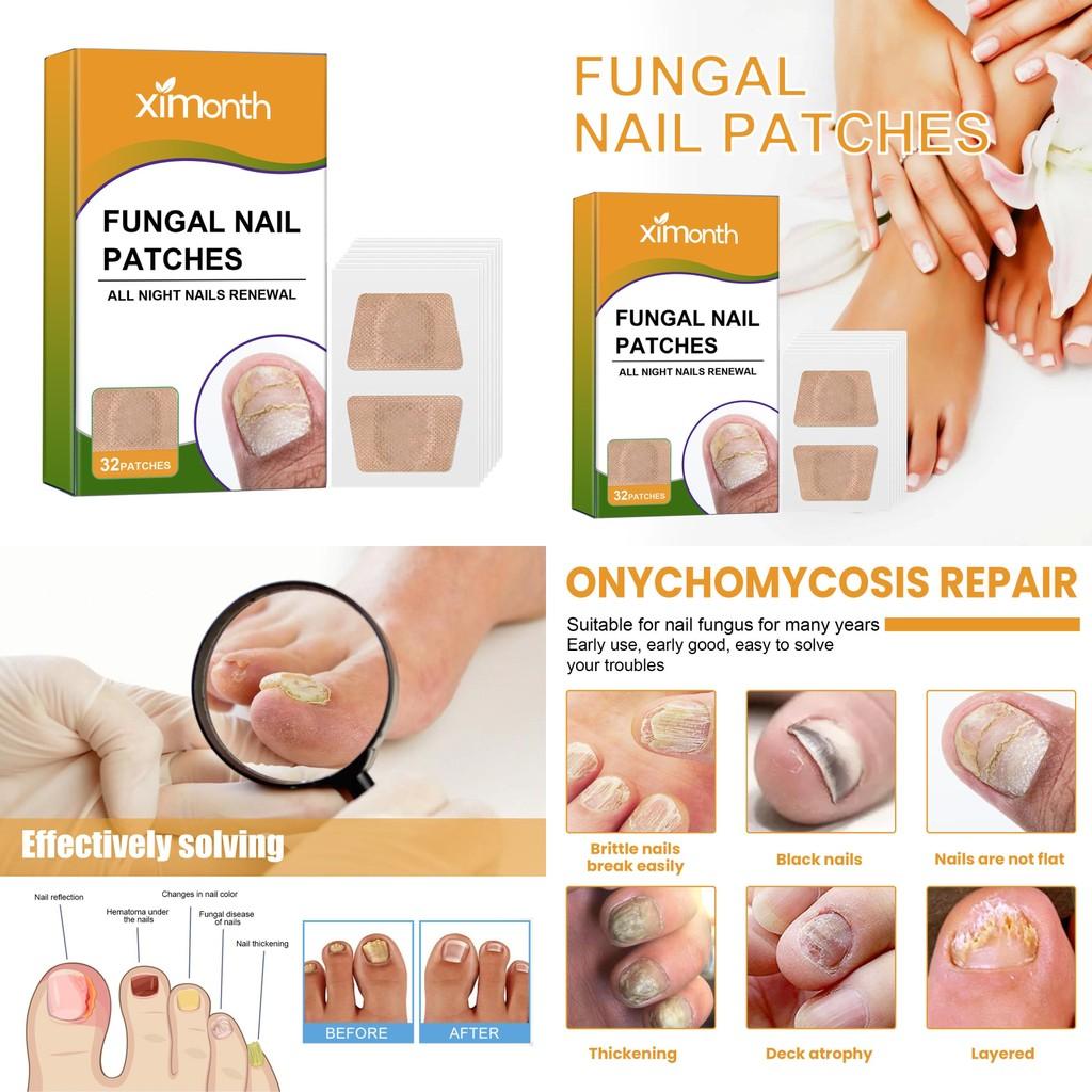 Ximonth Nail Repair Patch 32pcs Softening Thickening Treatment For Damaged Nails