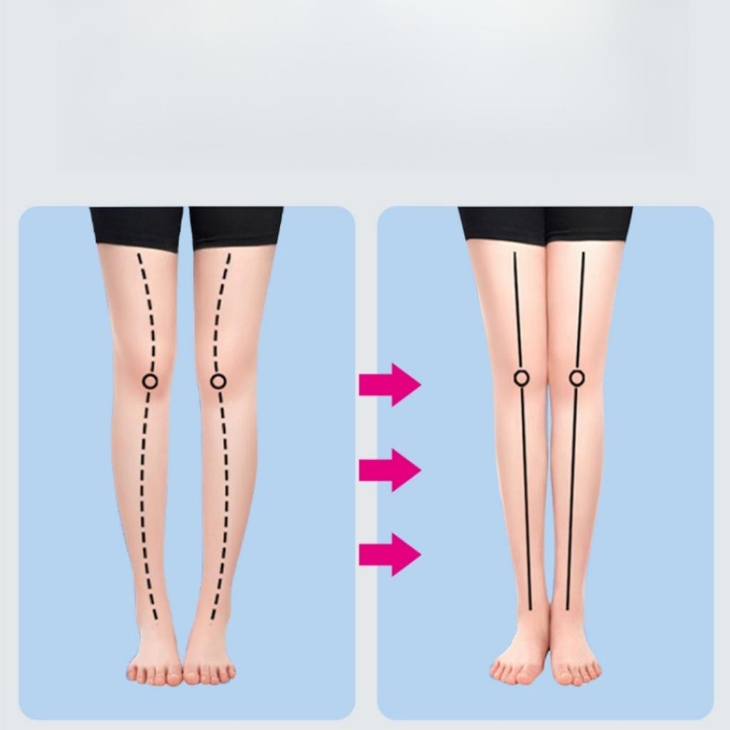 Unisex, Leg Shape, Inner and Outer, Eight Foot, Flat Foot, O-foot, Arch, Suitable for X-shape