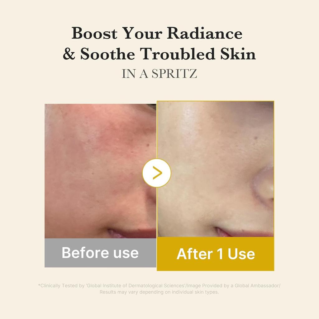 Medicube Kojisäure Kurkuma Vita Jelly Mist Serum 100ml