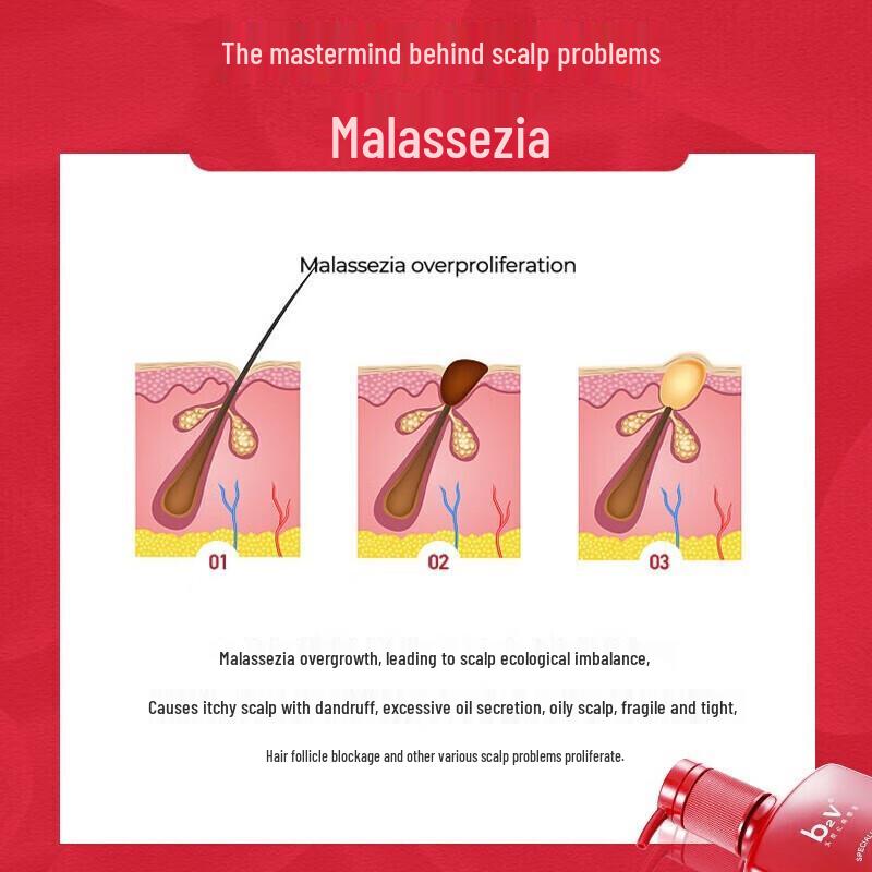 b2v Red Algae Silicone-Free Anti-Itch Oil Control Shampoo