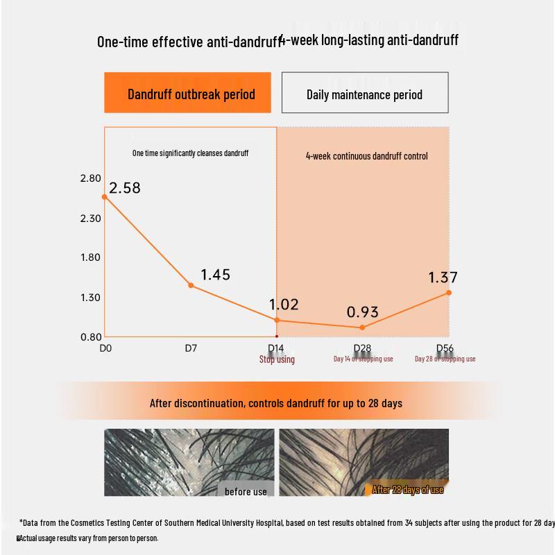 Zhirun Anti-Dandruff Shampoo & Softening Conditioner