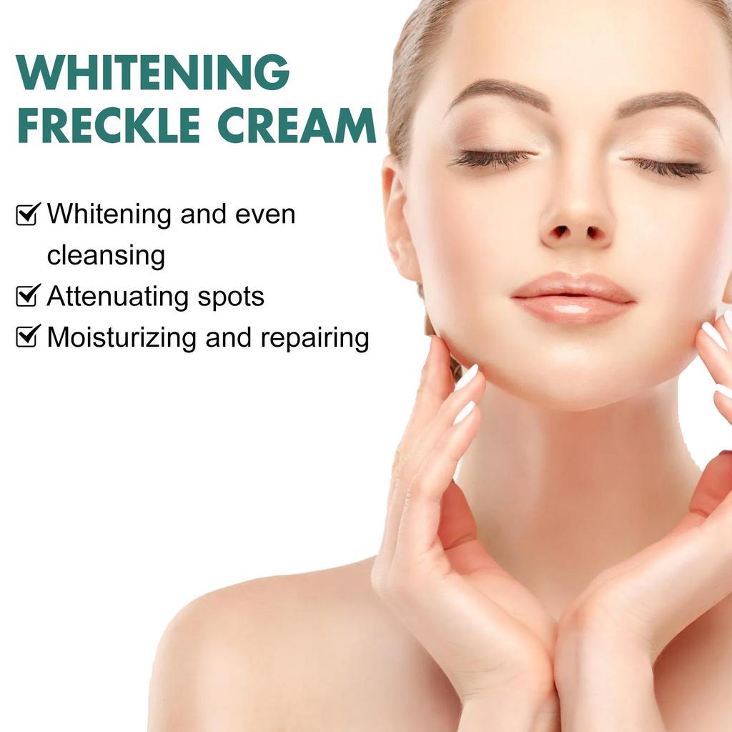 EELHOE Nicotinamid-Sommersprossencreme, feuchtigkeitsspendende Gesichtsaufhellungsreparatur, Hautpflege, Melasma-Entferner, Pigmententfernungscreme, 30 g
