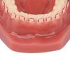 Ceramic Dental Orthodontic Demonstration Model Teeth Model with Metal Wires and Bracket for Teaching Learning