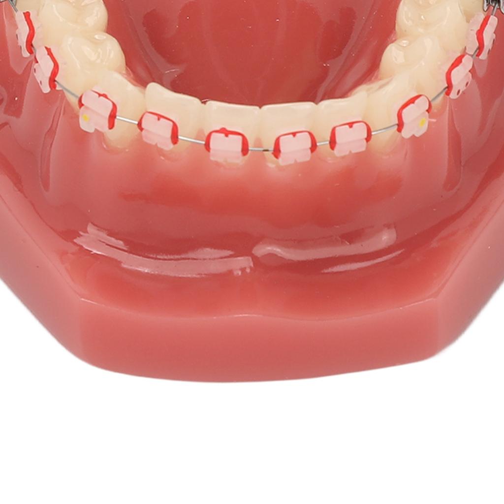 Ceramic Dental Orthodontic Demonstration Model Teeth Model with Metal Wires and Bracket for Teaching Learning