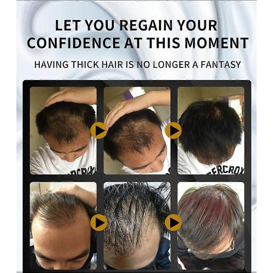 5% Hair Growth Spray, Extra Strength Hair Regrowth Treatments with Biotin 20ml