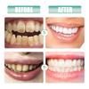 Oralhoe Nicotinamide Whitening Toothpaste 100g Brightens Teeth, Removes Stains & Plaque, Freshens Breath, Oral Care