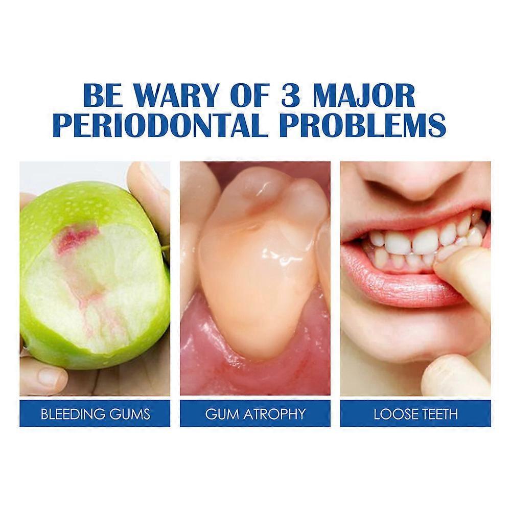 3x Mint Toothpaste Clean Gingival Tooth Fixation Toothpaste Curing Teeth Soothing Gingival Pain Toothpaste