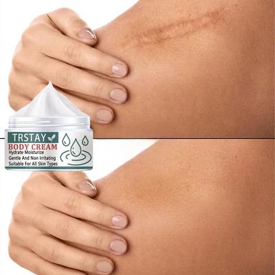 Scratch repair jizva krém strie popáleniny císařský řez jizvy jizvy operace jizvy olej