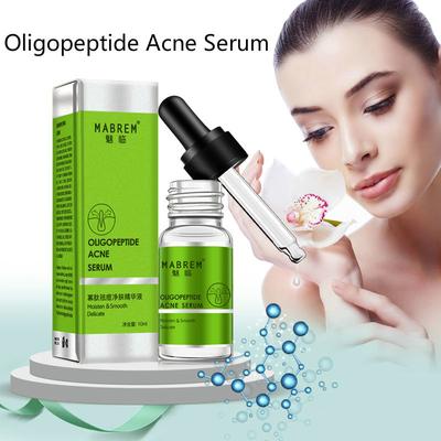 Oligopeptide Acne Clearing Serum Treatment Cream Pore Repair Anti Aging Moisturizing Essence