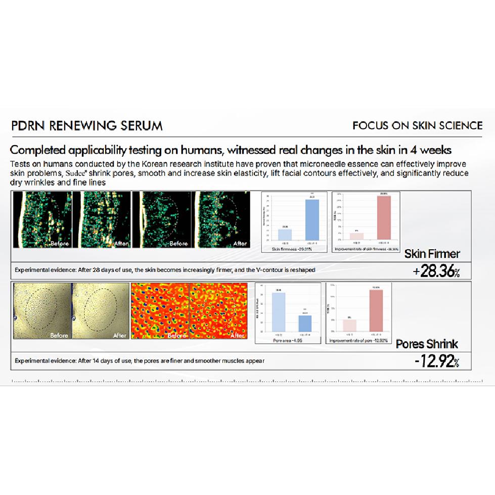 Sudee PDRN Renewing Serum 100/COLLAGEN 300 30ml ( Smooth Fine Lines and Wrinkles Take Care of The Skin Barrier Maintain Skin Hydration )
