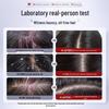 Three Hair Wizards Selenium Sulfide Oil Control Anti-Dandruff Shampoo