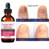 Liquid For Manicure Protects Hands And Toenails\30ml