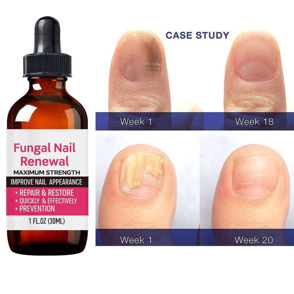 Liquid For Manicure Protects Hands And Toenails\30ml